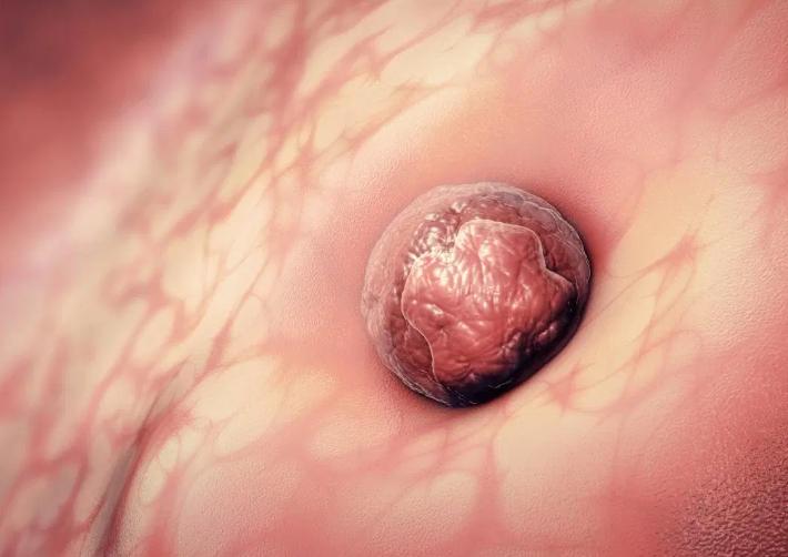 胚胎着床出血能用验孕棒吗,胚胎宝宝着床在干些什么