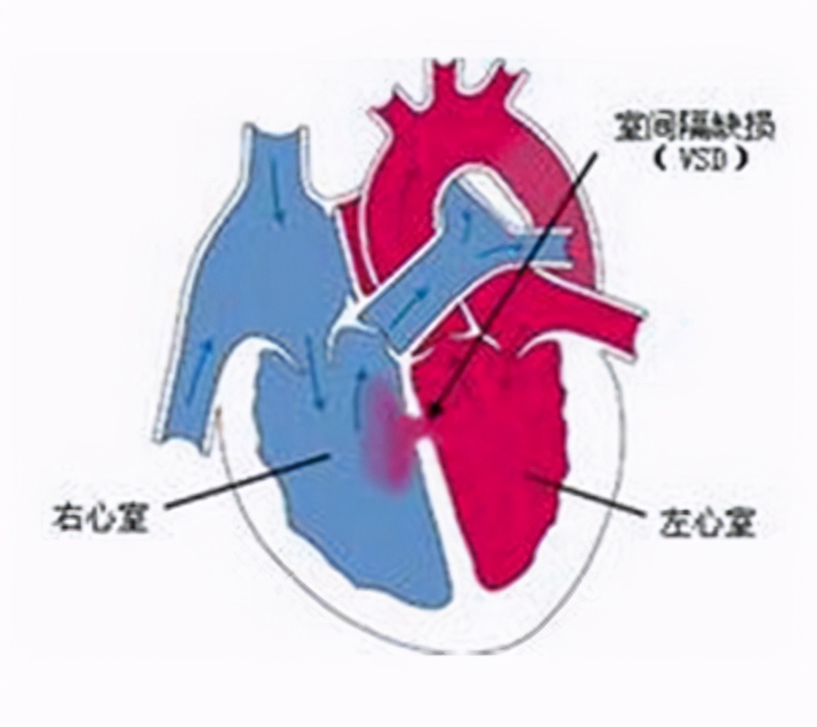 新手爸妈必看婴幼儿护理,新手爸妈要知道的四个儿科医生