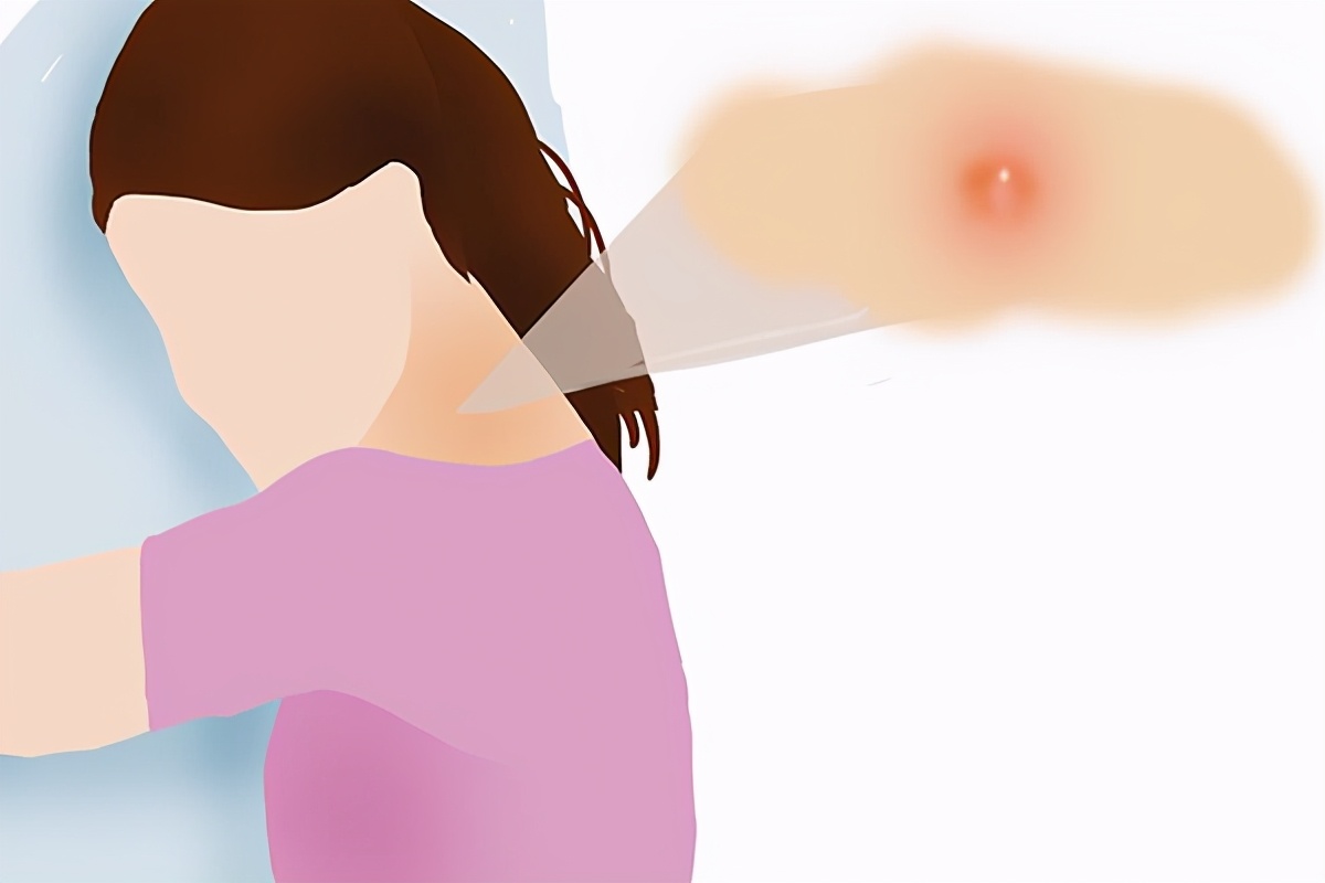 脖子上有小肉粒不处理可以吗,脖子上的透明小肉粒怎么去除