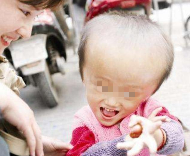 喝了三鹿奶粉的孩子如今怎么样了,曾经喝三鹿奶粉的孩子们怎么样了