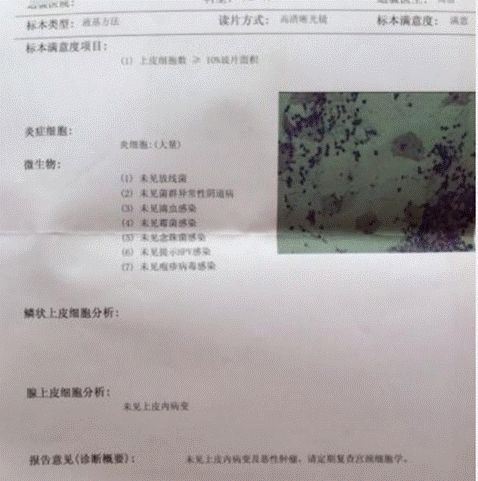 和hpv抗争十四年,我的hpv4价疫苗心得