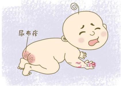 如何有效预防宝宝红屁股,预防宝宝红屁股快速好方法