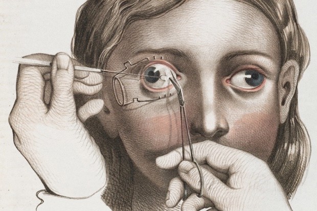 曾经的手术是一场噩梦吗,曾经的心脏手术