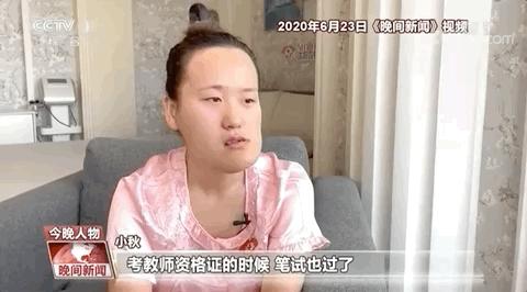 面部畸形整形的女孩,先天面部畸形整形
