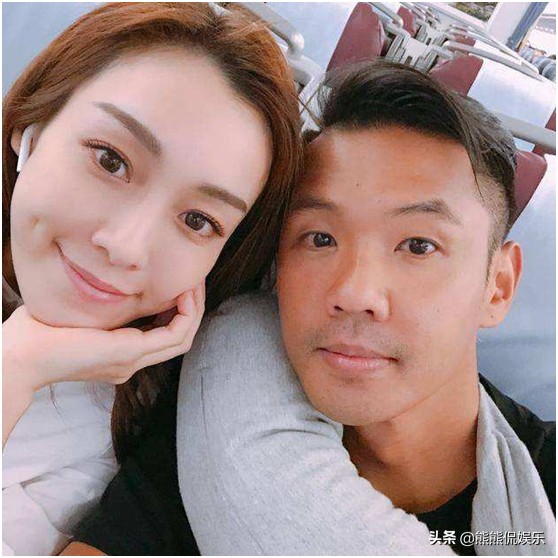 范玮琪不慎摔伤，下把六厘米伤口缝15针，伤口深可见骨