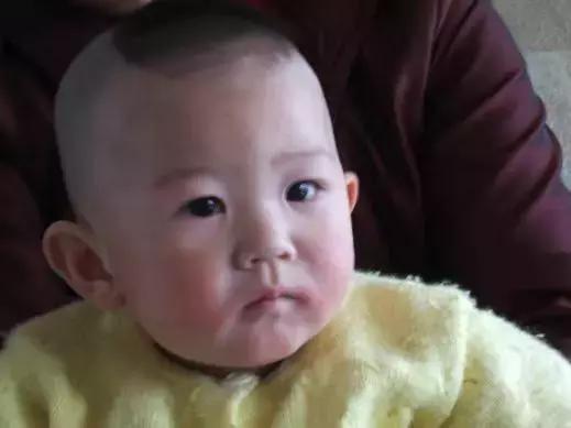 怀孕湿疹反反复复如何彻底根除,孕妇湿疹怎么治好得快