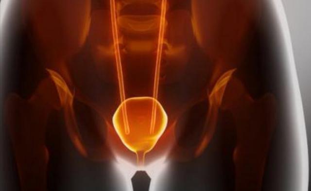 一喝水就尿多是肾脏出问题了吗,一喝水就尿多代表肾脏好还是不好