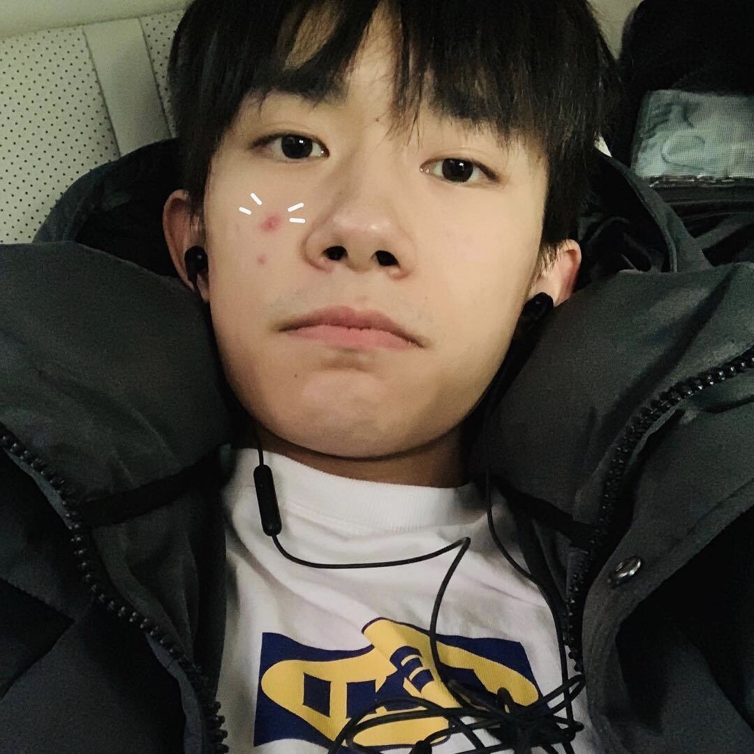 脸部不同地方长痘原因及解决方法,脸上各部位长痘的原因和解决方案