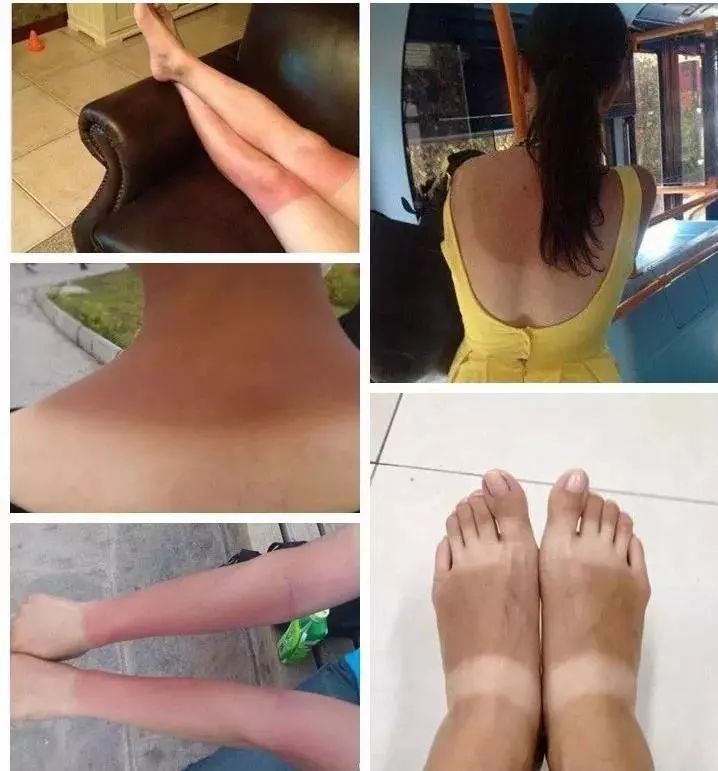 王鸥露背照片,王鸥最新露背写真