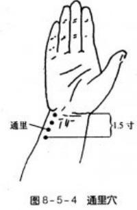 十大实用针灸穴位,针灸特殊穴位主治歌诀