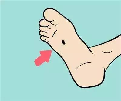 黑痣预防性去除有必要吗,原来去除黑痣是如此简单