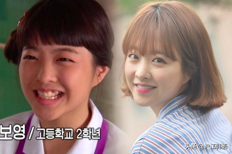 女明星矫正牙齿前后对比,明星牙齿矫正前后对比图