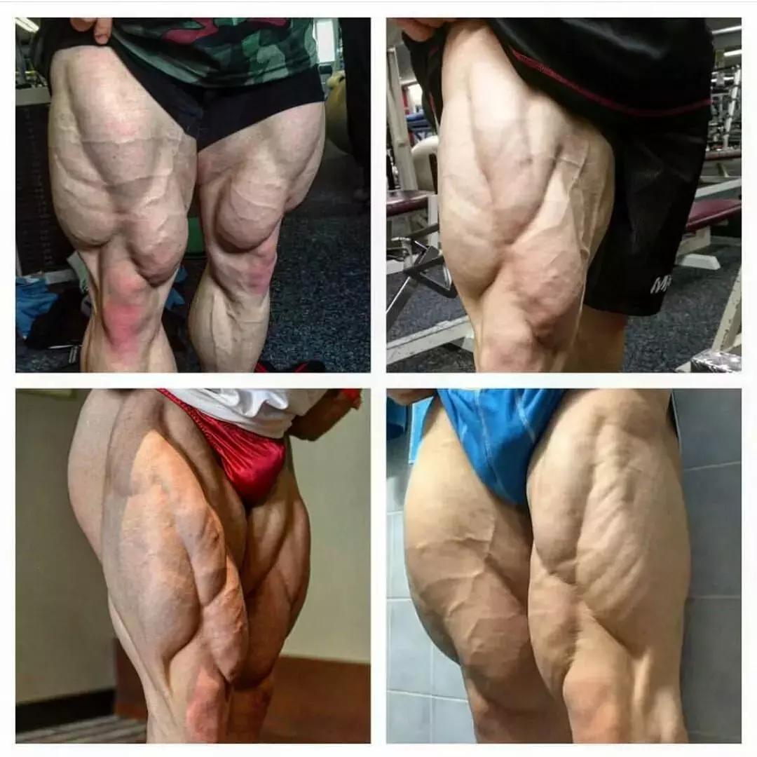 腿部拉筋可以改变腿型吗,腿部训练可以纠正腿型