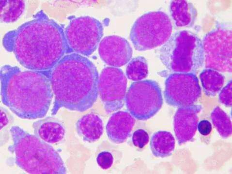 白细胞低医生说要做穿刺来检查,感冒发烧查血常规发现白细胞低