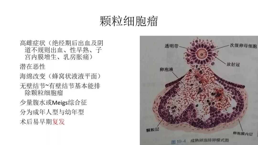 卵巢原发肿瘤的分析思路