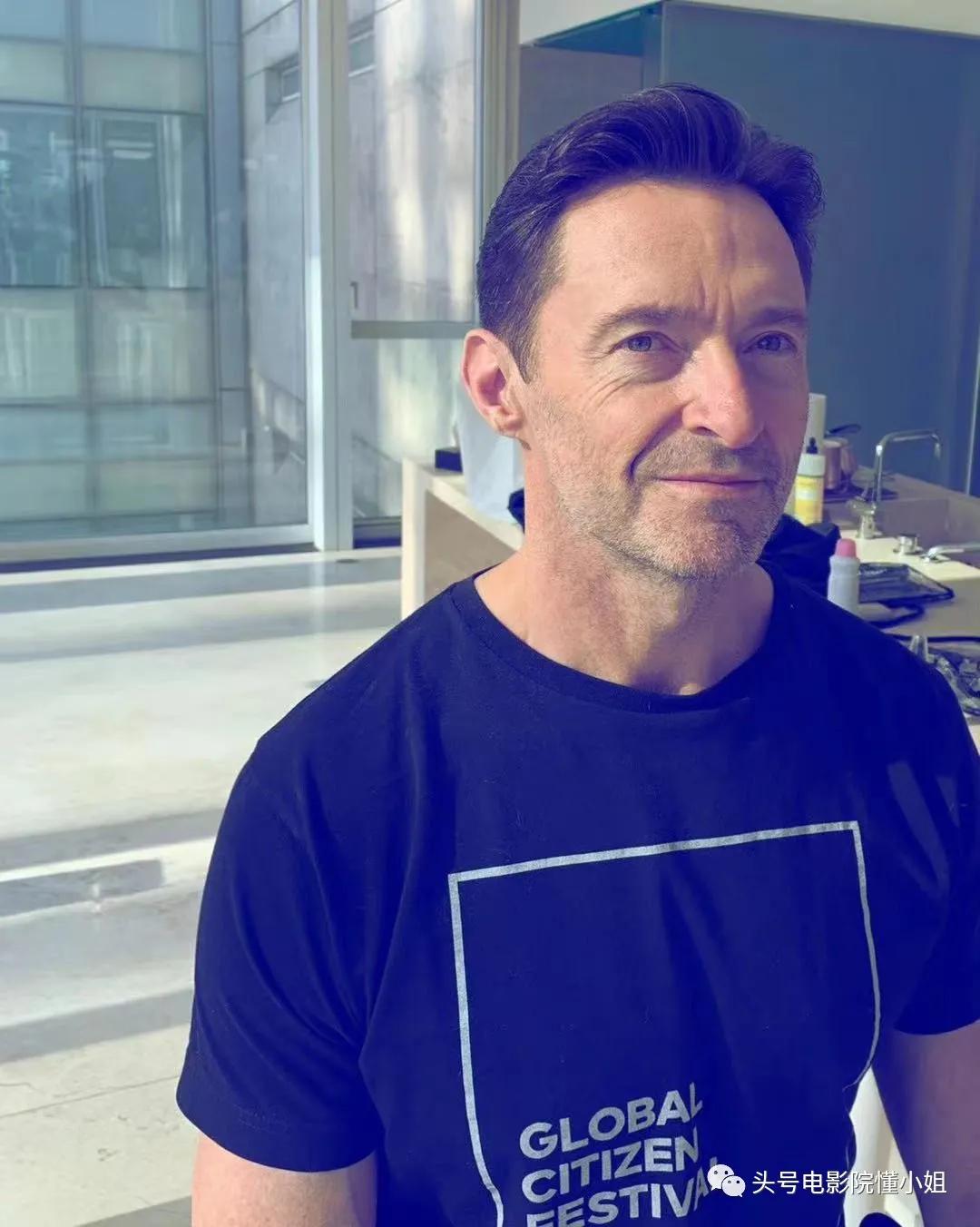 金刚狼爆皮肤癌危机！53岁休杰克曼提醒抹防晒霜，4年前曾动手术