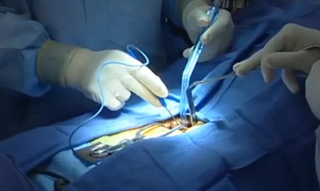 腰椎间盘突出用什么药,腰椎间盘突出正确锻炼方法