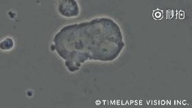 对抗病毒！我们身体内的卫士：NK细胞