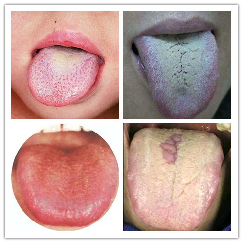 归脾丸是阳虚还是阴虚,归脾丸是养肝还是伤肝