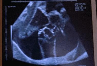 不作死就不会死新娘,不作死就不会死外科风云