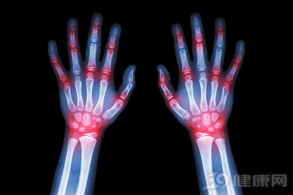 风湿形成的原因视频解析,风湿产生的原因