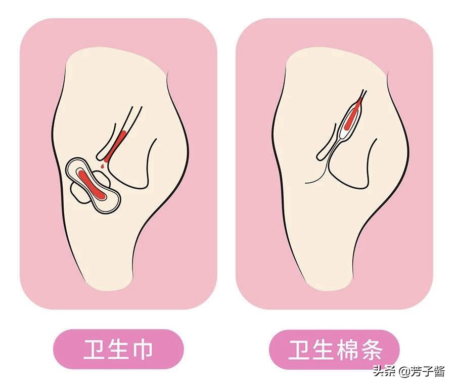 第一次使用卫生棉条感觉有点干燥,第一次用卫生棉条要注意什么