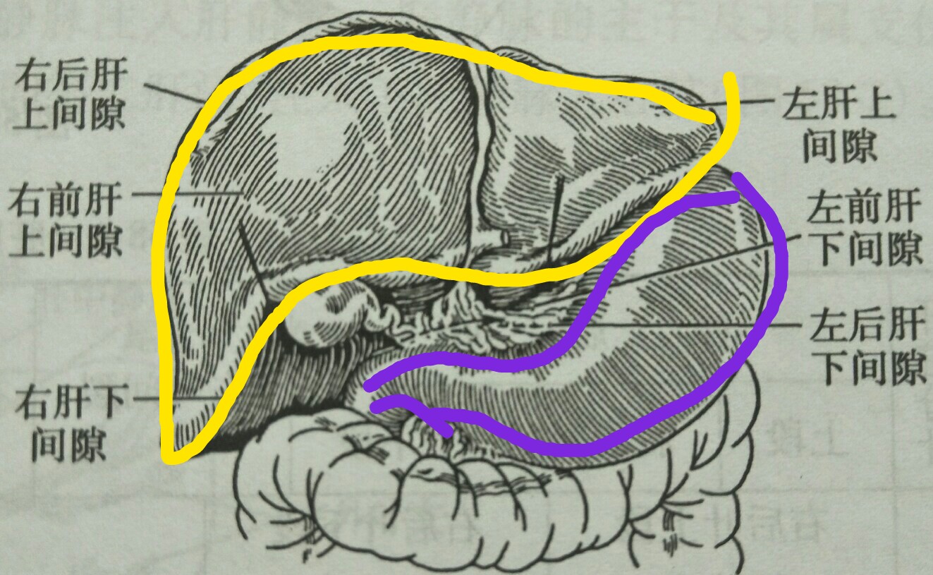 胃癌肝和肺有结节是转移了吗,胃癌扩散到淋巴和肝脏能手术吗