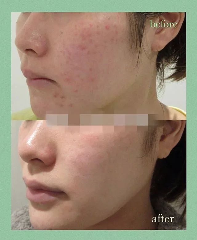 面霜推荐原来它才是干皮亲妈,有被称为干皮亲妈的面霜推荐吗