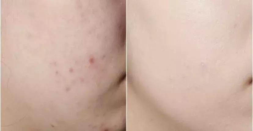 日本女生美白方法,日本美女美白皮肤