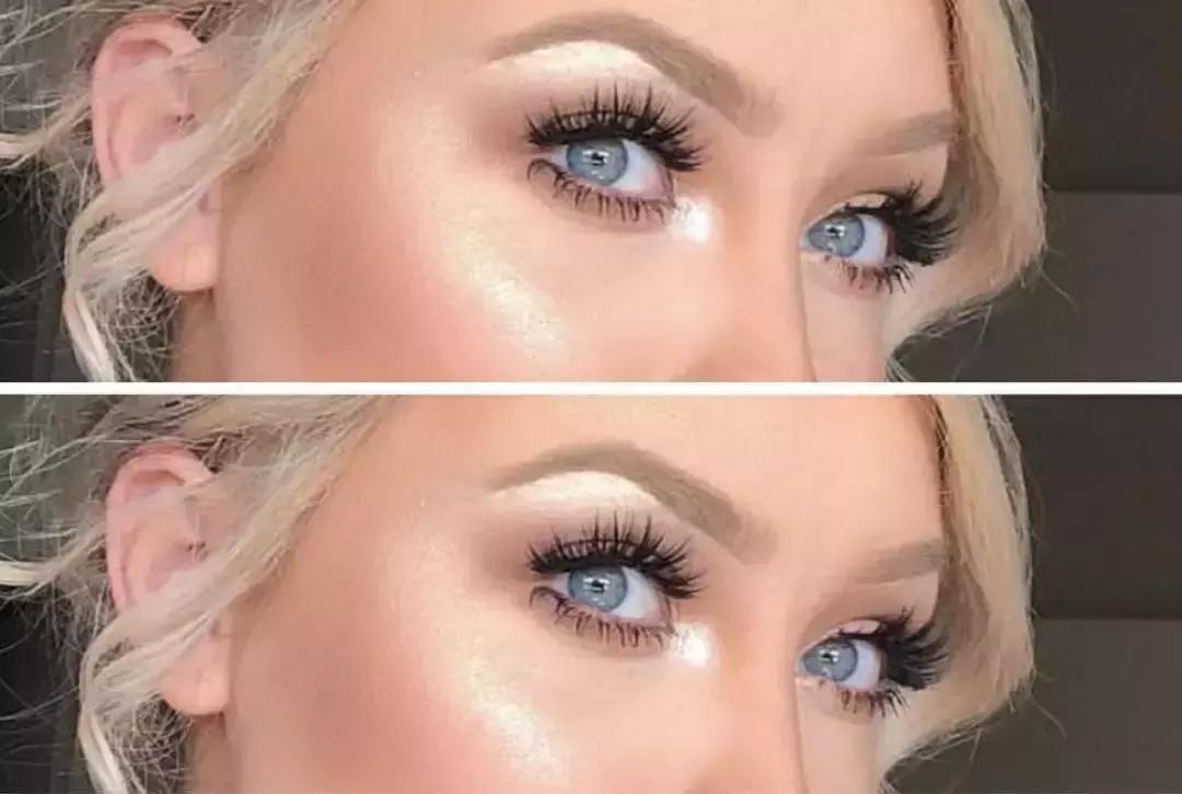 欧阳娜娜擦什么药膏好,欧阳娜娜安利祛疤膏