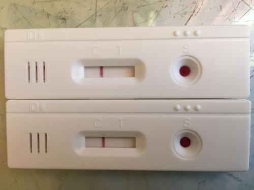 艾滋病检查哪些指标可以判断,如何判断艾滋病自我检查