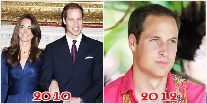 发量减少好不好,发量减小