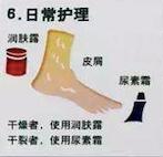 糖尿病足负压护理及观察要点,糖尿病足居家护理