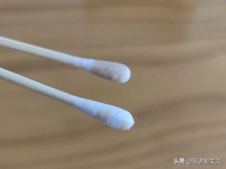 皮肤瘙痒耳朵也瘙痒是怎么回事,耳朵止痒最灵的土方法