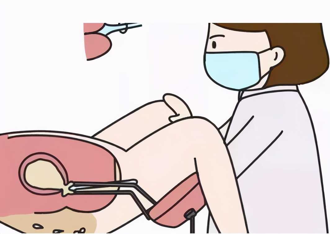 妇产超声科检查什么,妇产科检查超声一般是有什么问题