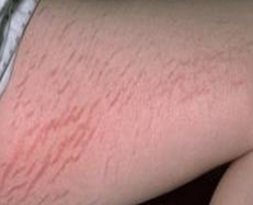 夏天孕期身体乳推荐哪款,孕妇可以用的身体保湿乳推荐