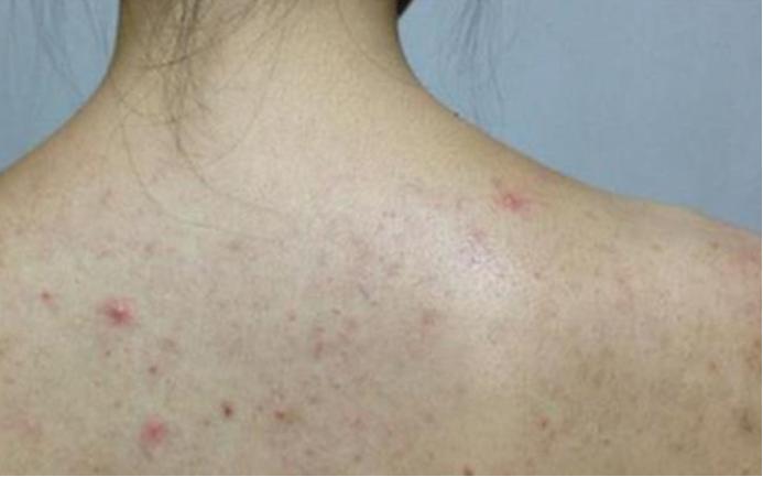 日本懒人搓澡巾,日系碳纤维搓澡巾