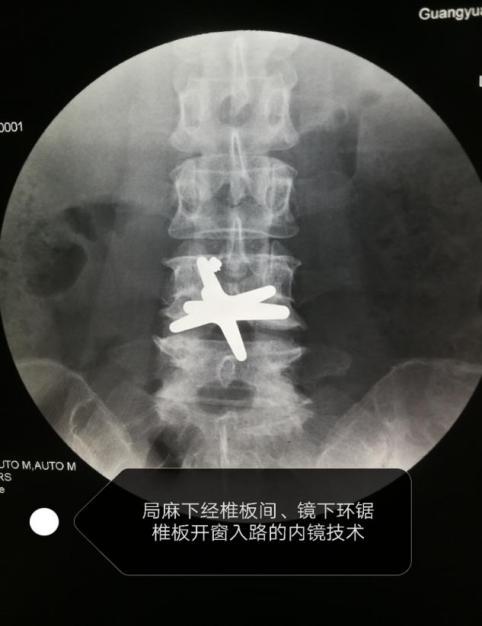 那天，市第二人民医院收到一件特殊的包裹……