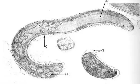 制造丧尸：病毒、*品毒**和寄生虫