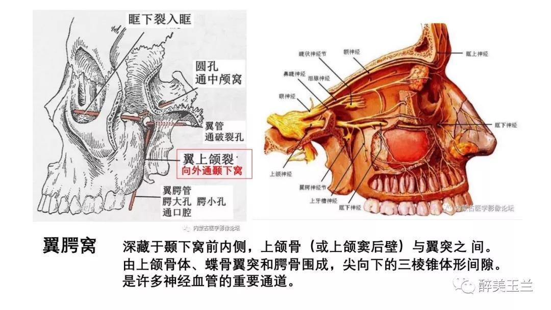 病例分享丨三叉神经节微球囊压迫术的麻醉管理