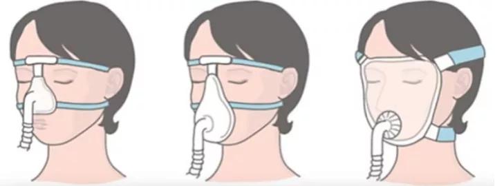 icu对患者实施必要的保护性治疗吗,icu生命支持系统