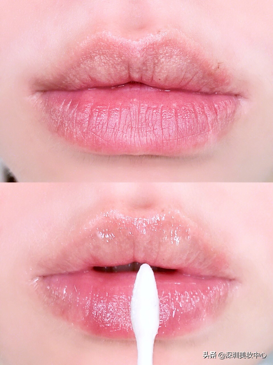 女生有小胡子怎么办小妙招,怎样去除女人嘴唇胡须