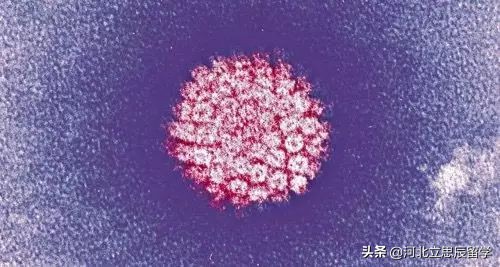 澳大利亚人发明的东西 (澳洲发明了什么全世界都在用)