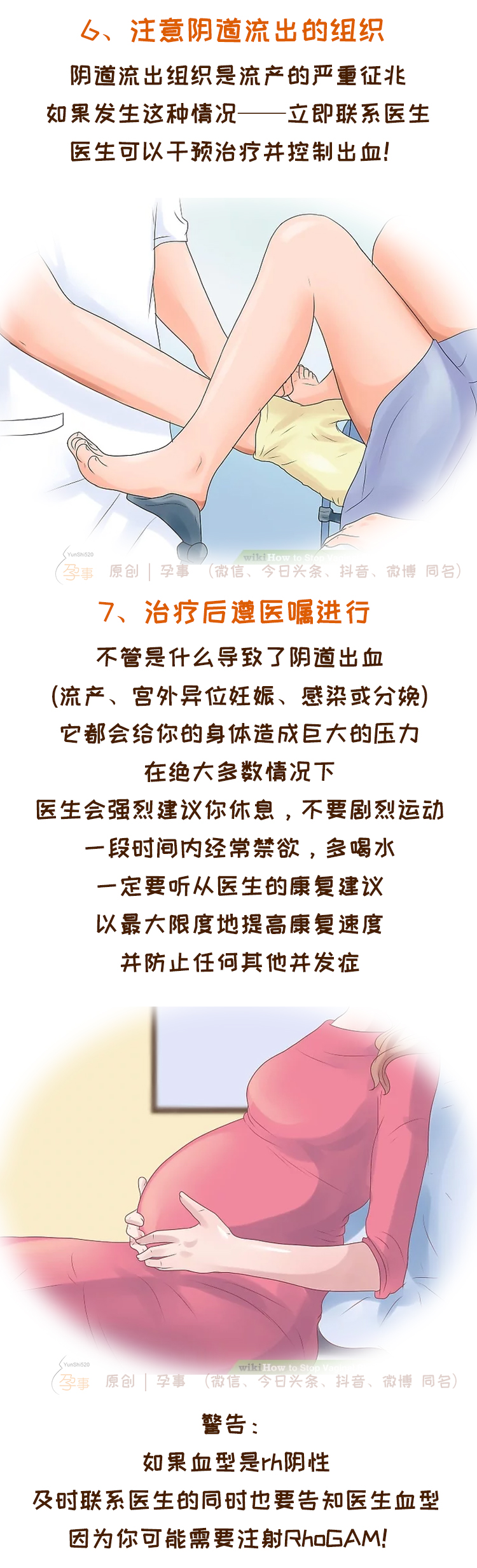 孕期见红是什么原因怎么办,孕妈妈必看孕期见红分别代表什么