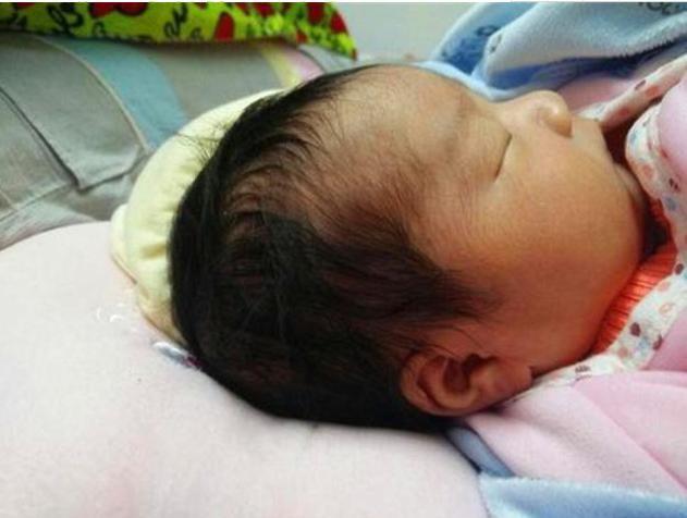 宝宝后脑勺老是往后顶,宝宝老是头偏一边婆婆老说烦死了