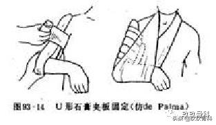 骨科术前术后注意事项,骨科手术体位安置标准流程