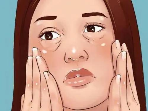 脸上浮肿与心脏有关吗,脸上长疹子眼睑浮肿怎么办