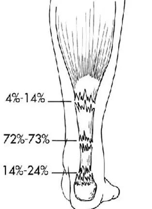 杜兰特对猛龙跟腱受伤视频,伤病猛于虎下一句