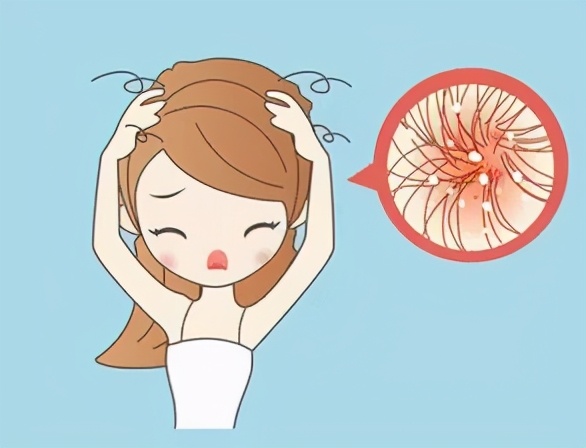 头屑像下雪一样是什么原因,头屑一抓像下雪怎样治