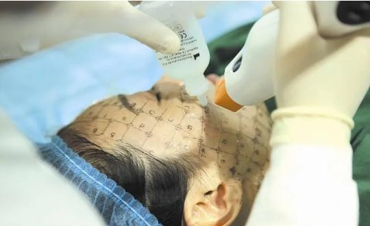 经常说的医美是什么,你真的了解医美吗